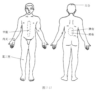 砭石調理胃下垂