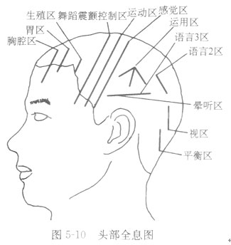 砭石療法
