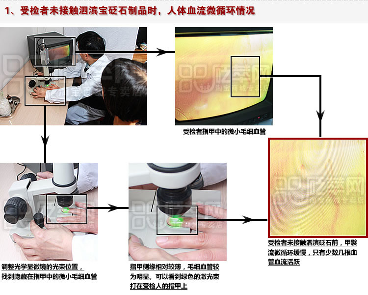 砭石學堂：泗濱砭石對人體甲襞微循環血流速度影響的定量檢測圖4