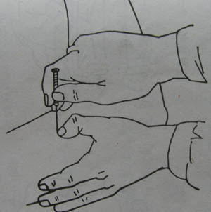 針灸
