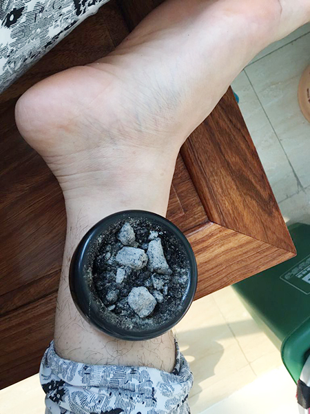使用砭石灸盒的五點(diǎn)注意事項,趕緊看看!