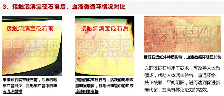 甲襞流微循環測試